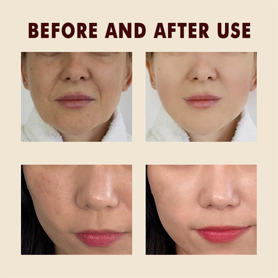 Peel Shot Glow Rice Ampoule Duo