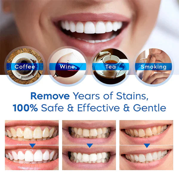 Teeth Whitening Essence Serum