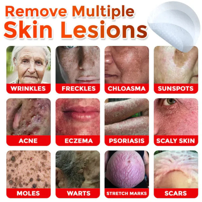 Skin Tag Removal Patches ✨(9PCS)