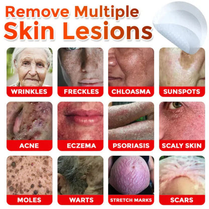 Skin Tag Removal Patches ✨(9PCS)