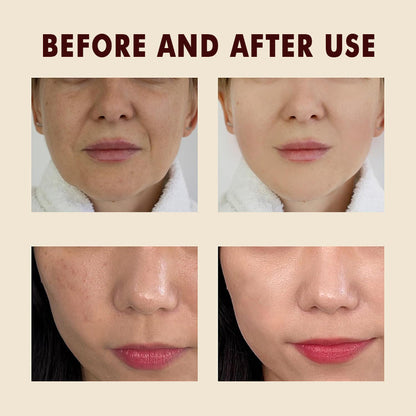 Peel Shot Glow Rice Ampoule Duo