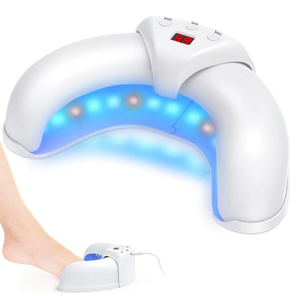 Laser behandelingvoor Schimmelnagels