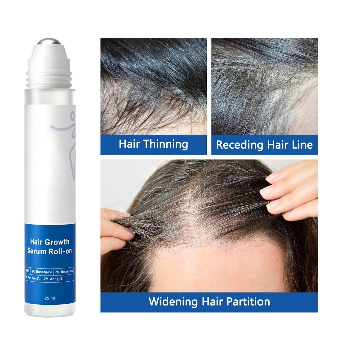 Hair Growth Roll-On Serum