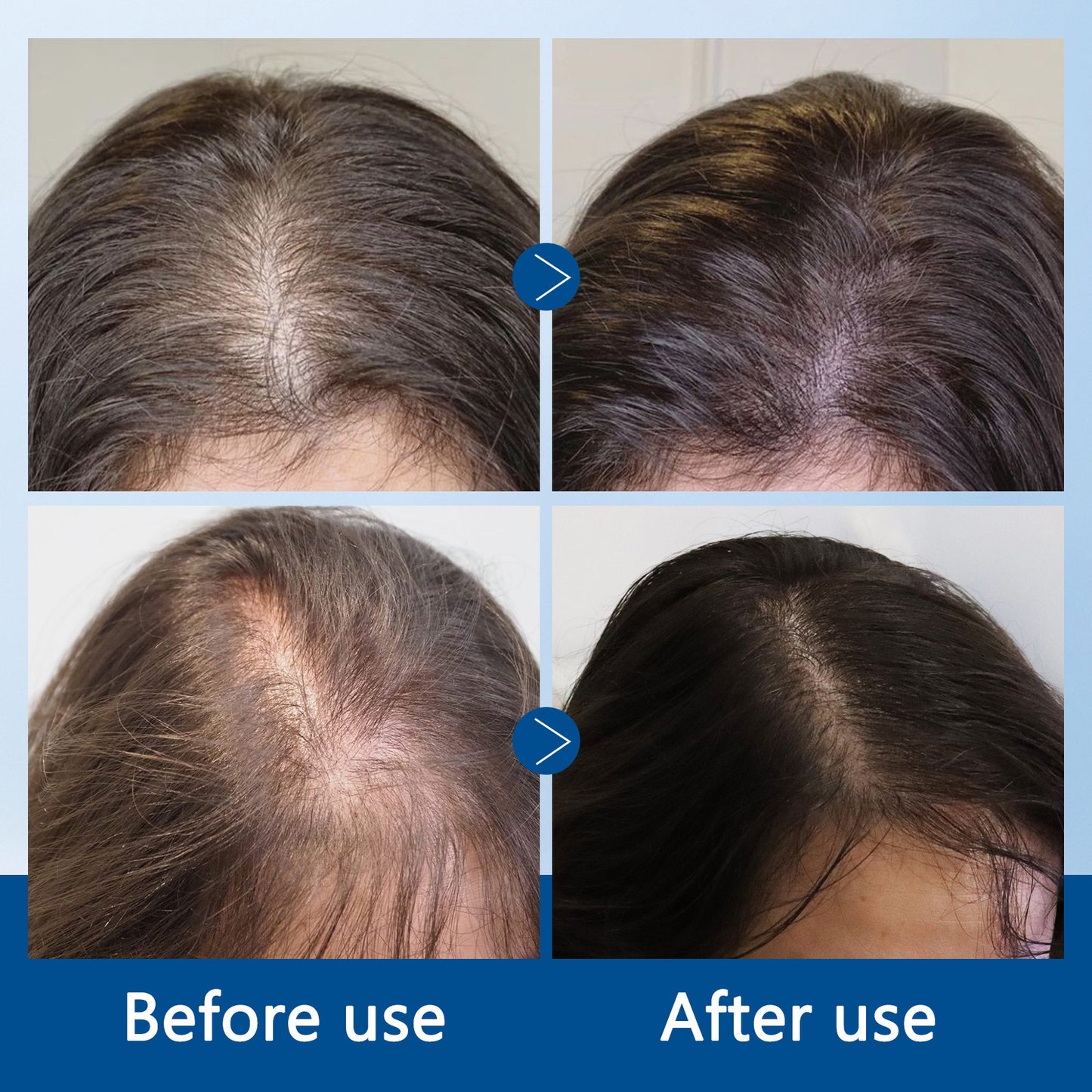 Hair Growth Roll-On Serum