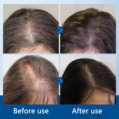 Hair Growth Roll-On Serum