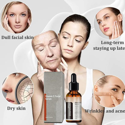 😃Vitamin C Facial Serum Essence, Hydration, Skin Moisturized（30ml）