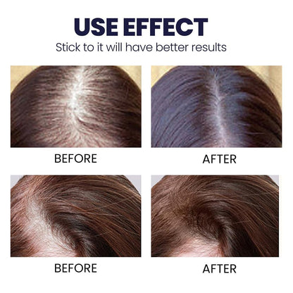 Natural Hair Regrowth Spray