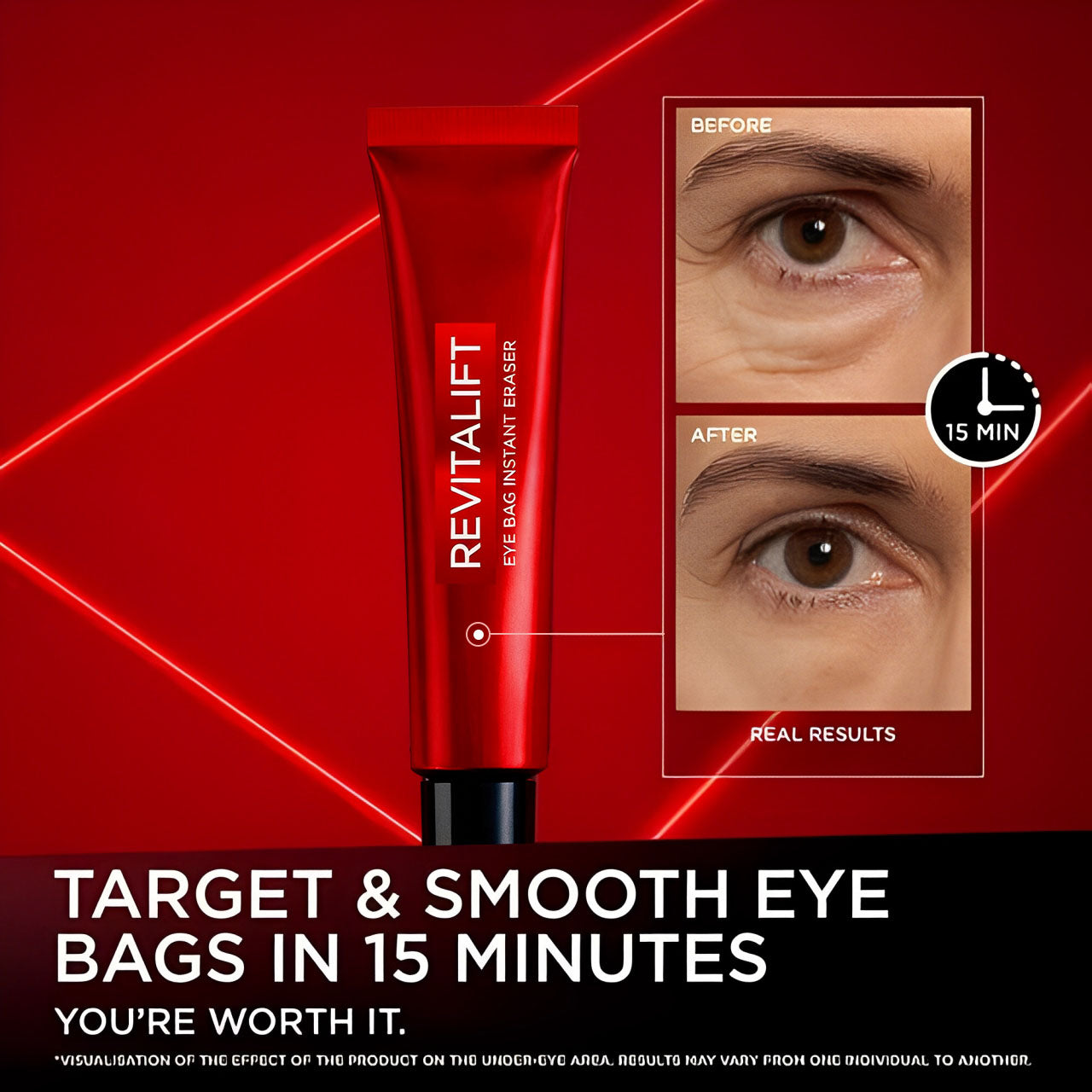 Revitalift Eye Bag Instant Eraser