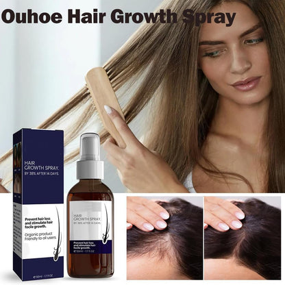 Natural Hair Regrowth Spray