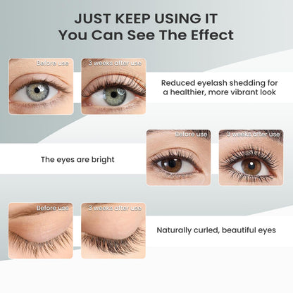 ✨Eyelash Serum – 6 Weeks to Longer Lashes