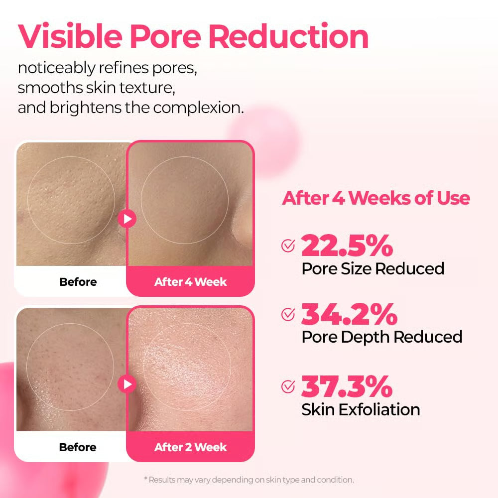 Pore & Spot Care Duo | Shrinks Pores & Fades Blemish Marks in 2 Weeks