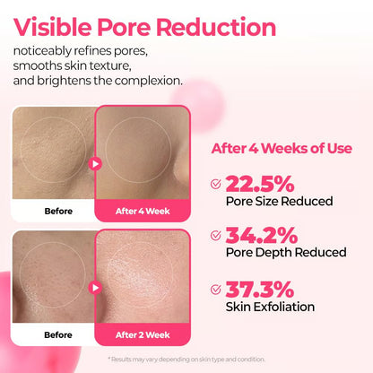 Pore & Spot Care Duo | Shrinks Pores & Fades Blemish Marks in 2 Weeks