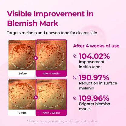Pore & Spot Care Duo | Shrinks Pores & Fades Blemish Marks in 2 Weeks