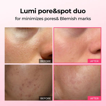 Pore & Spot Care Duo | Shrinks Pores & Fades Blemish Marks in 2 Weeks