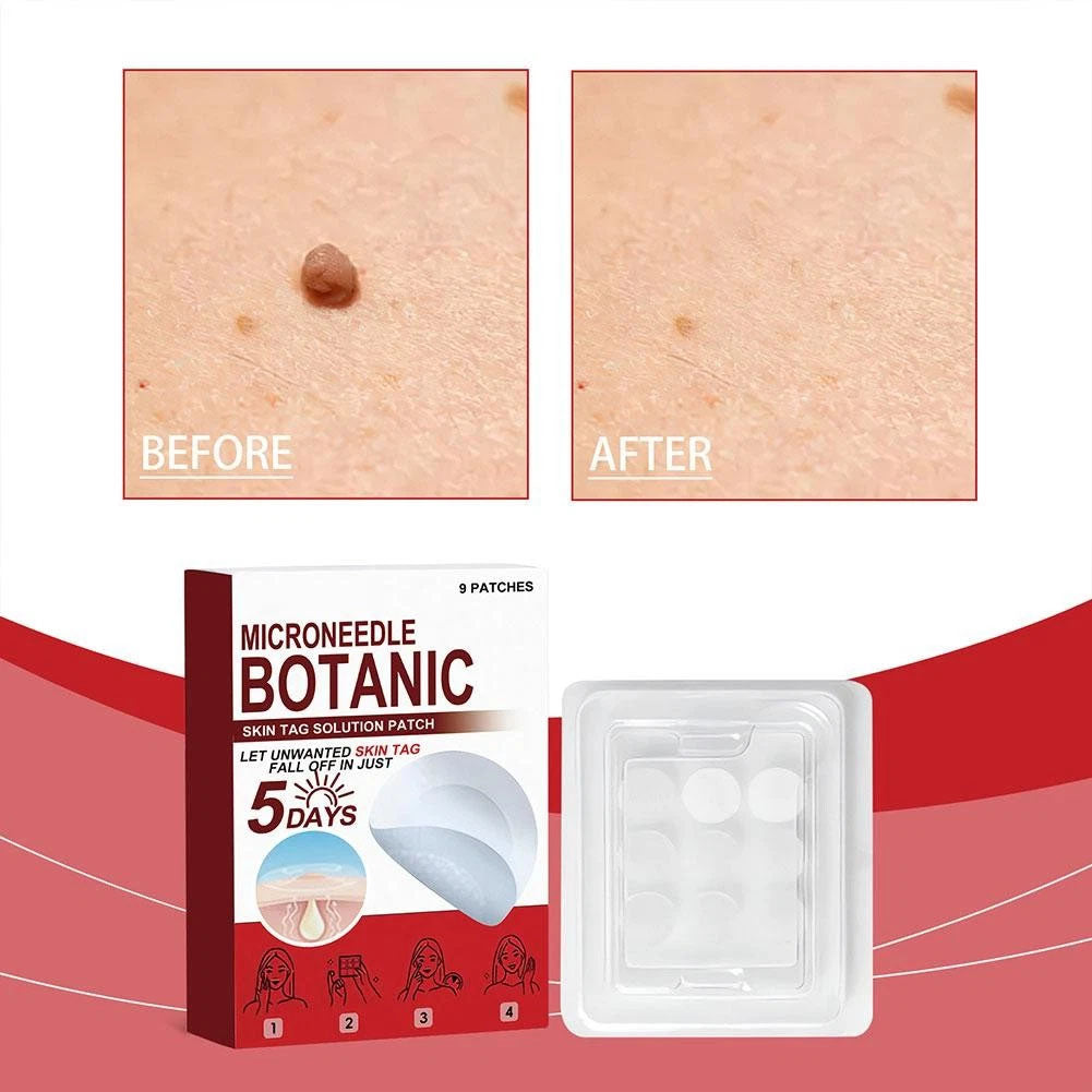 Skin Tag Removal Patches ✨(9PCS)