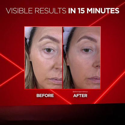 Revitalift Eye Bag Instant Eraser