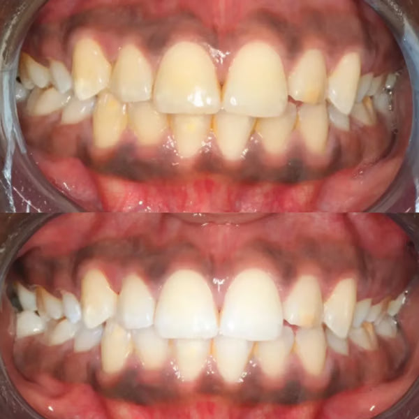 PAP+ Teeth Whitening Powder