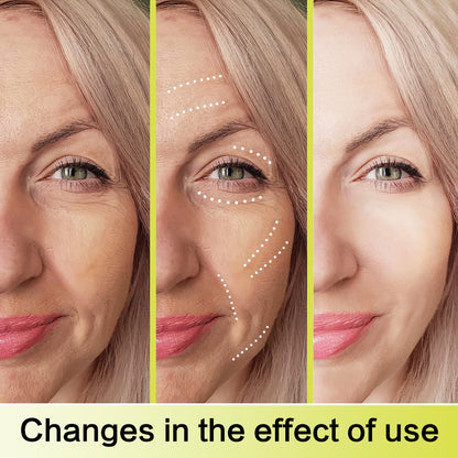 🔥The Vita-A Retinal Shot Tightening Booster
