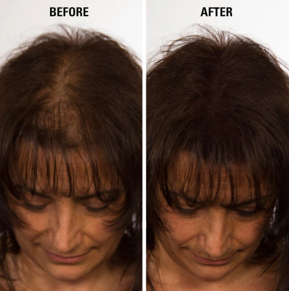 Natural Hair Regrowth Spray