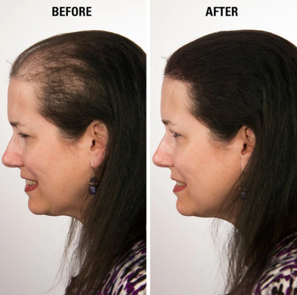 Natural Hair Regrowth Spray