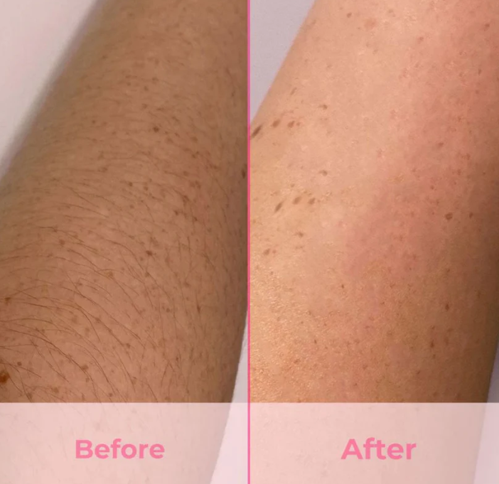 IPL Permanent Laser Hair Remover