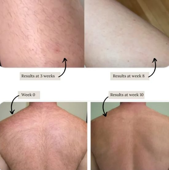 IPL Permanent Laser Hair Remover